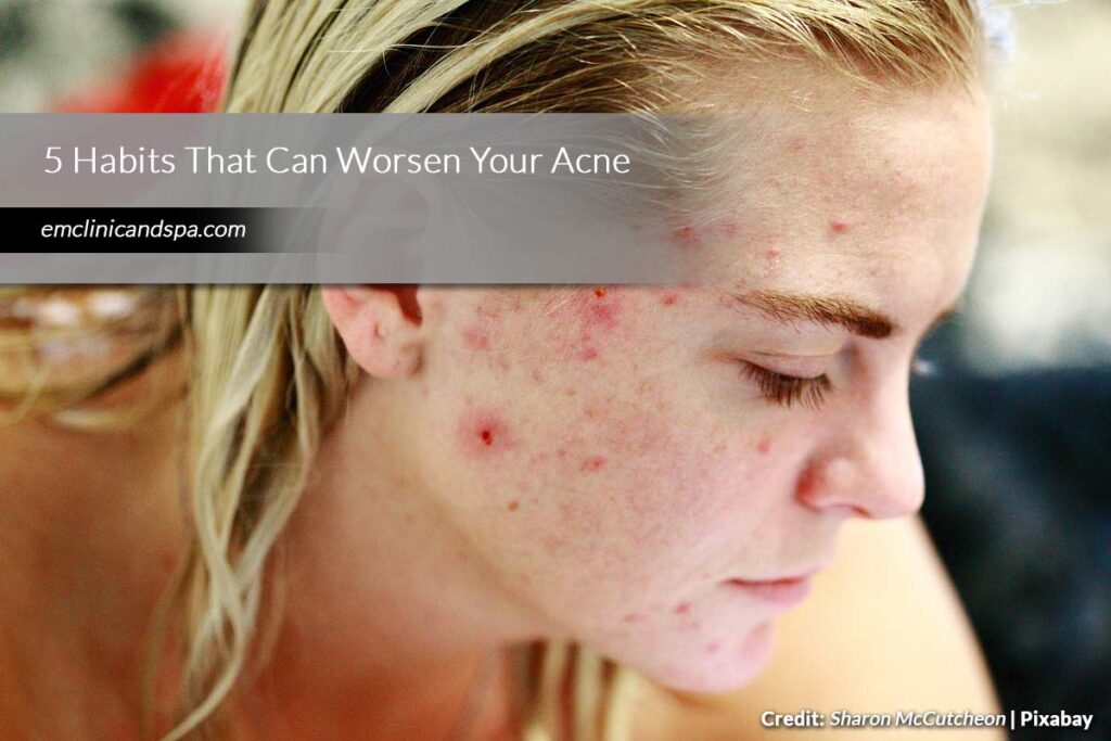 5 Habits That Can Worsen Your Acne
