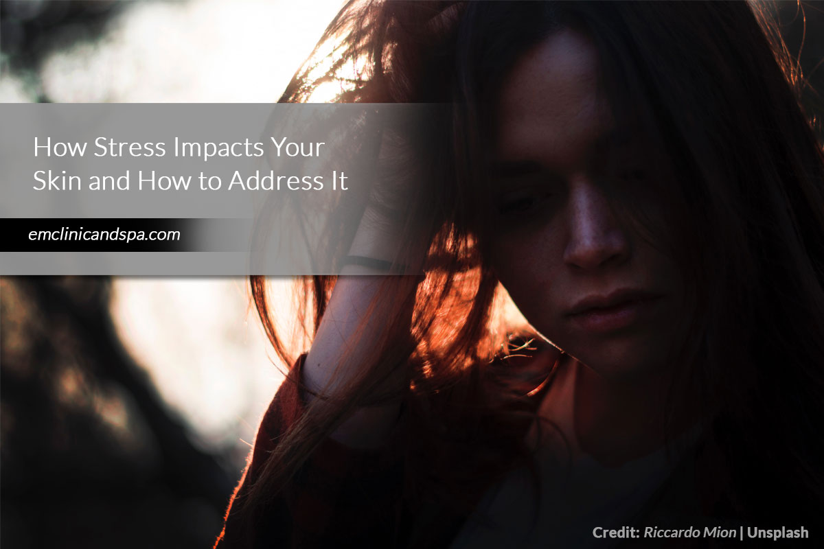 How Stress Impacts Your Skin and How to Address It