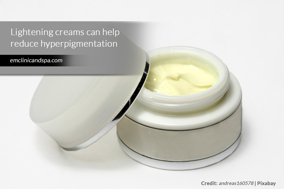 Lightening creams can help reduce hyperpigmentation