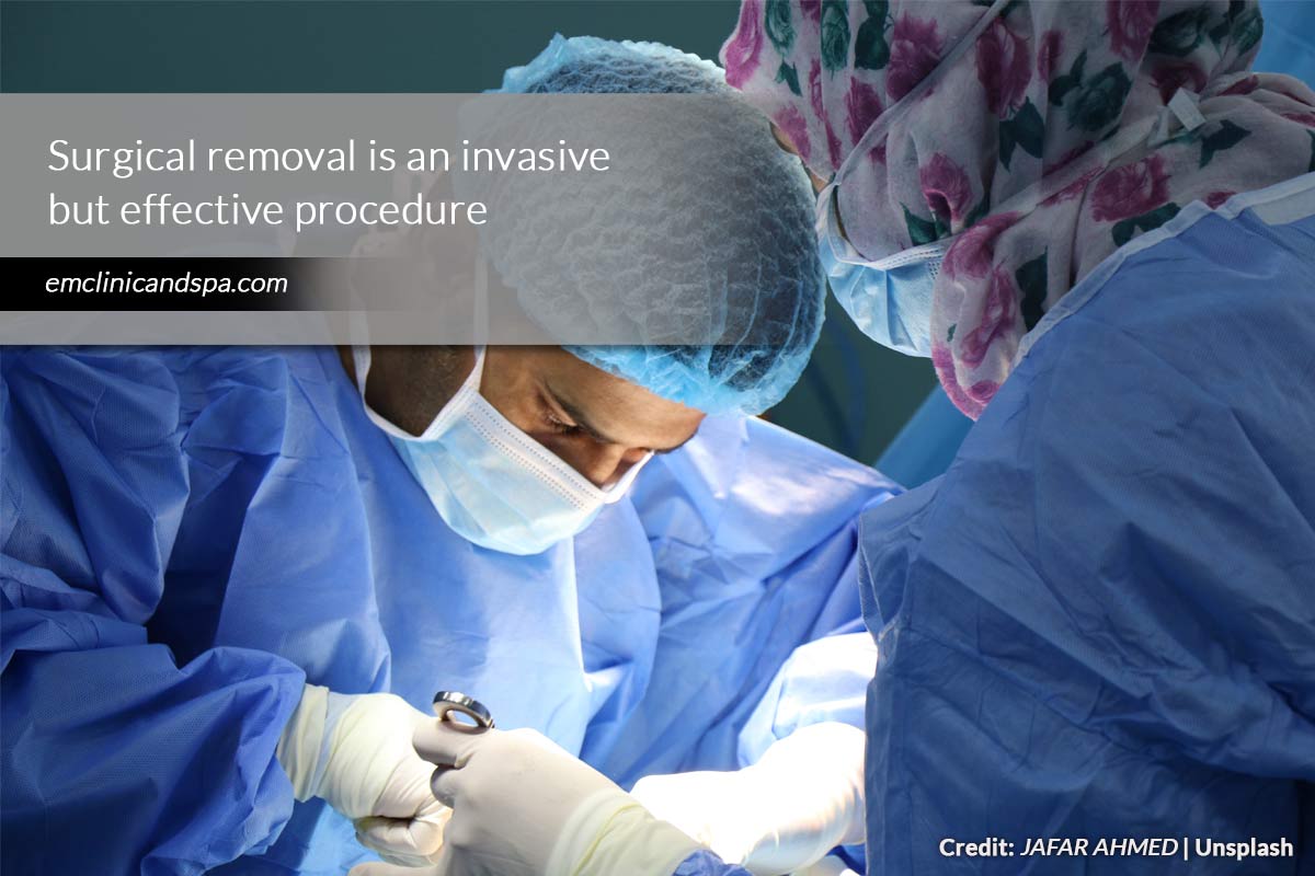 Surgical removal is an invasive but effective procedure