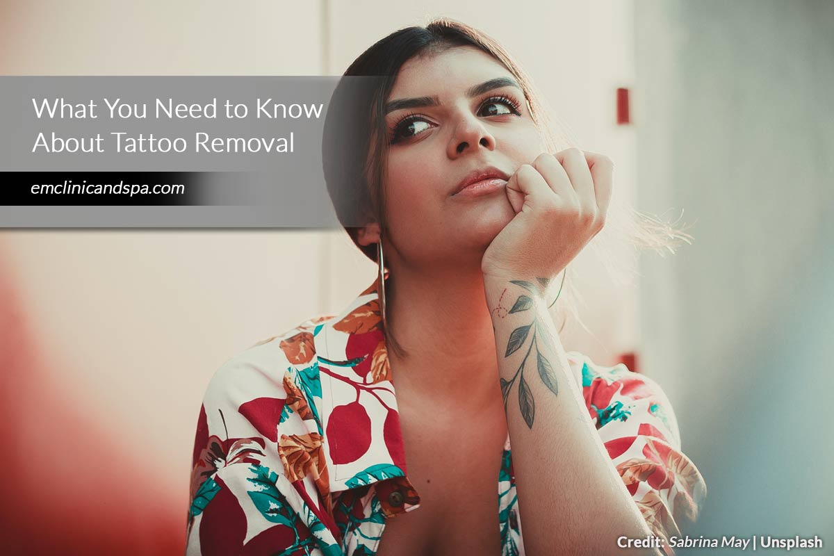 What You Need to Know About Tattoo Removal