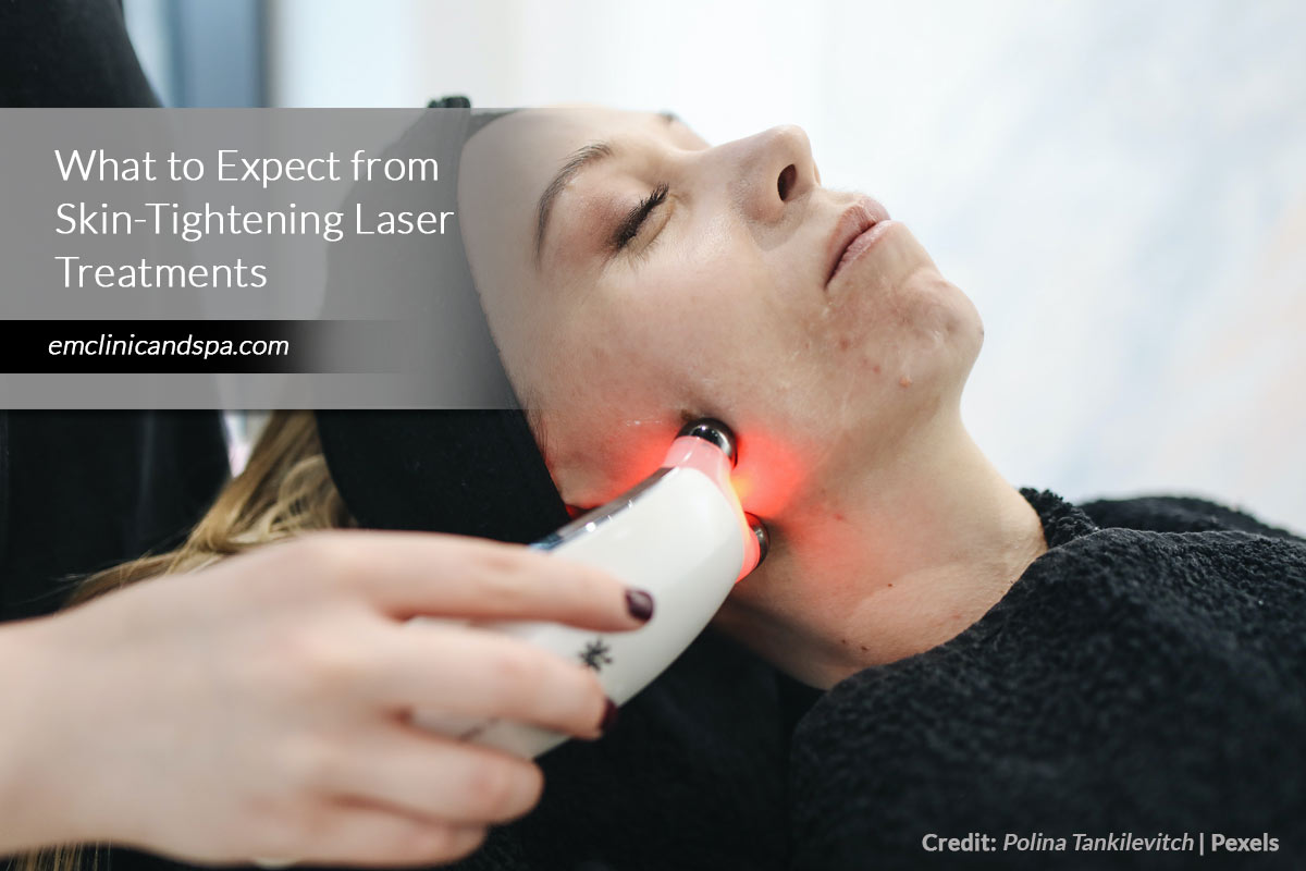 What to Expect from Skin-Tightening Laser Treatments