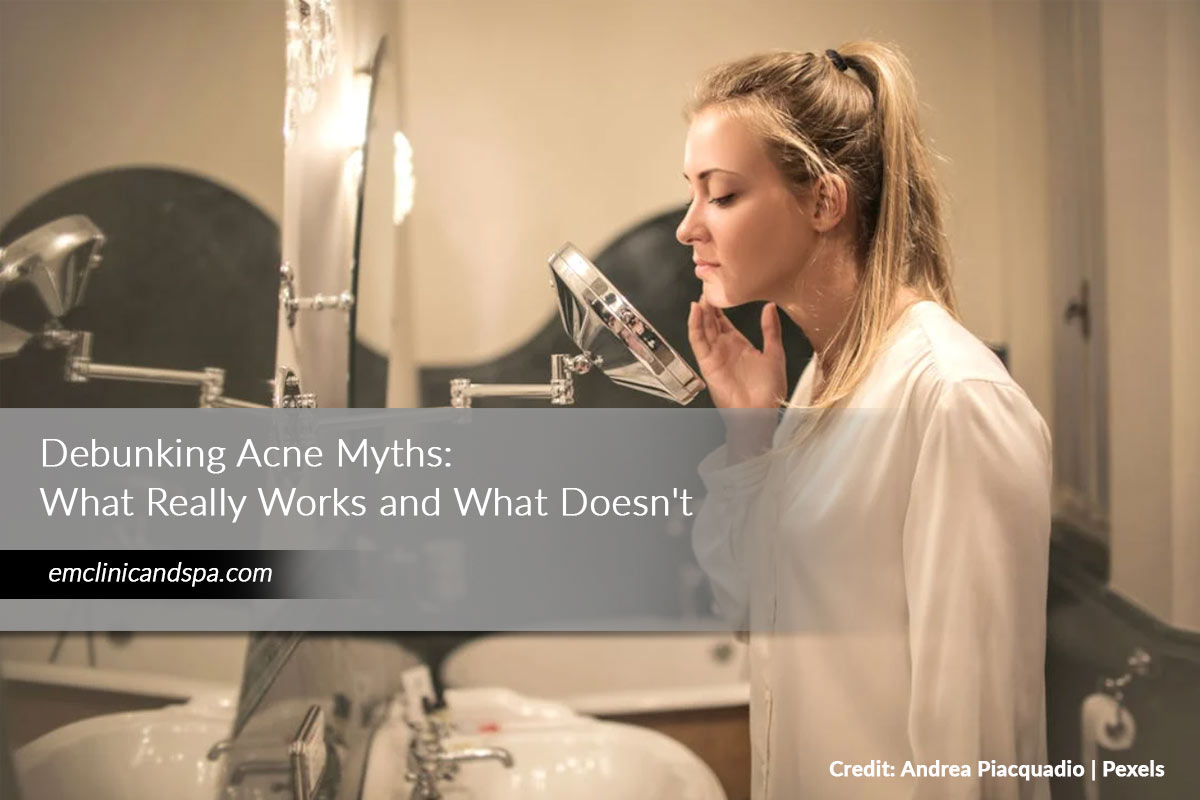 Debunking Acne Myths: What Really Works and What Doesn't - em clinic ...