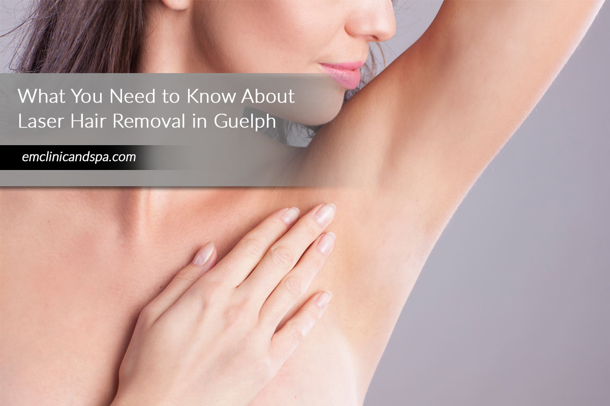 What You Need to Know About Laser Hair Removal in Guelph