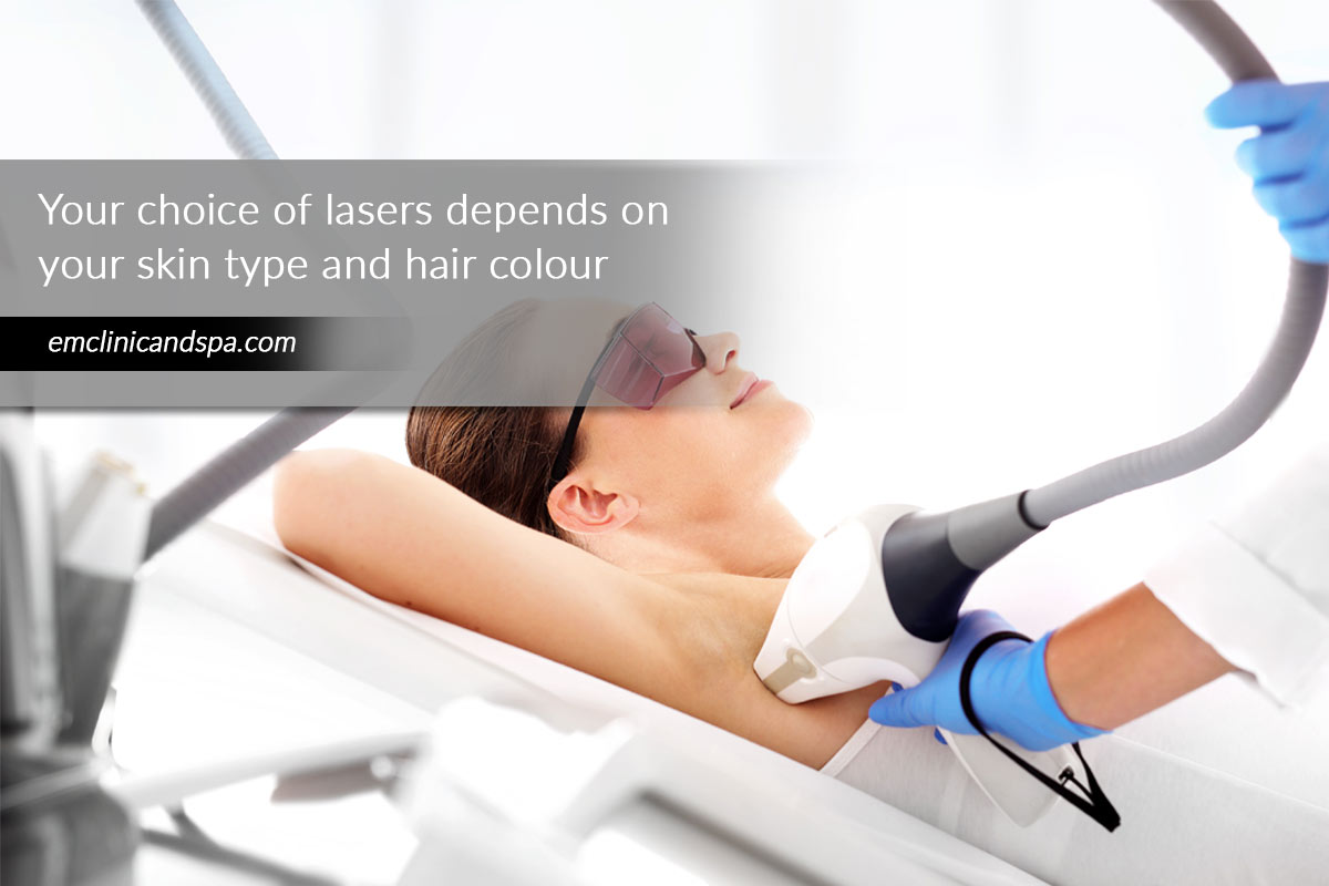 Your choice of lasers depends on your skin type and hair colour