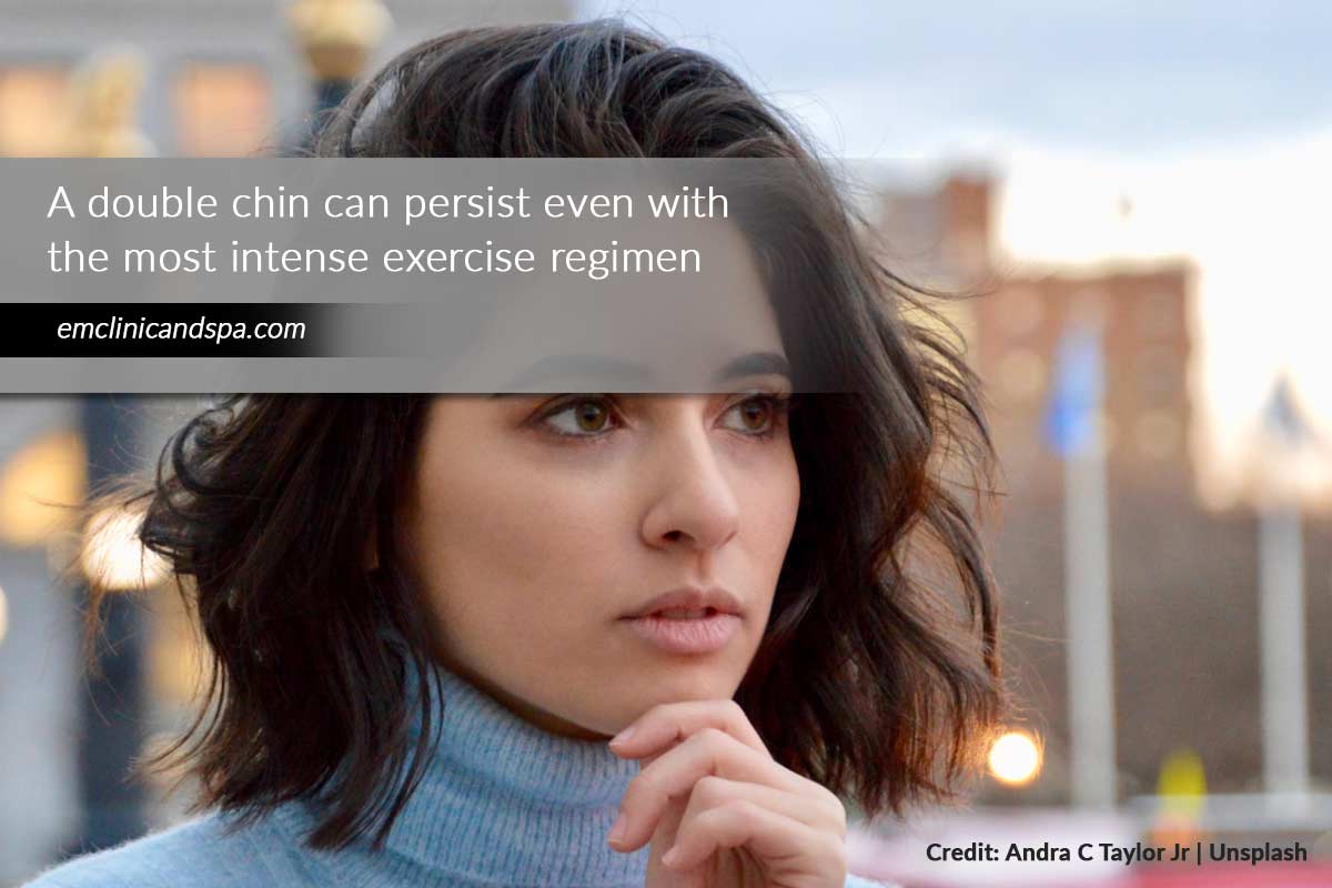 A double chin can persist even with the most intense exercise regimen