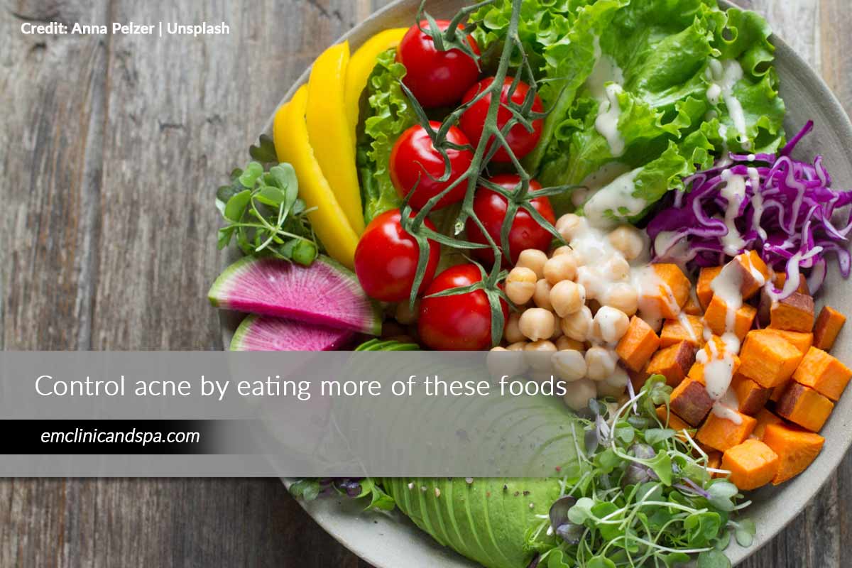 Control acne by eating more of these foods