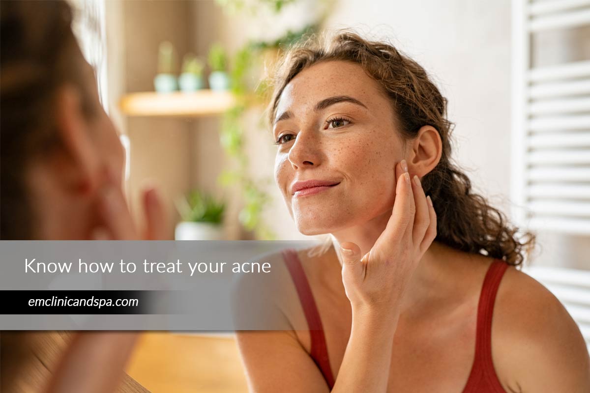 Know how to treat your acne