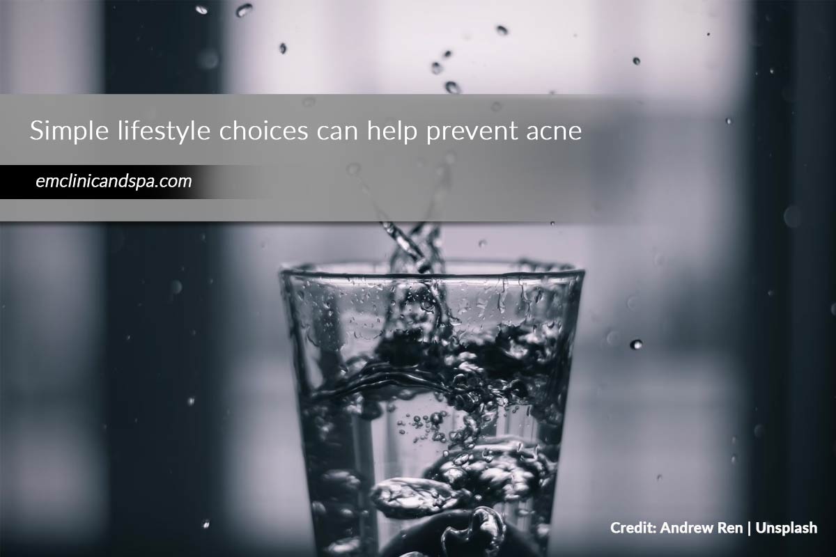 Simple lifestyle choices can help prevent acne