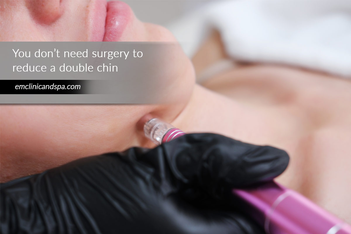You don’t need surgery to reduce a double chin