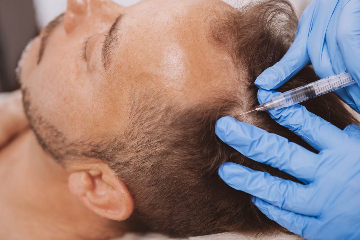 PRP uses the body's natural healing abilities to promote hair growth