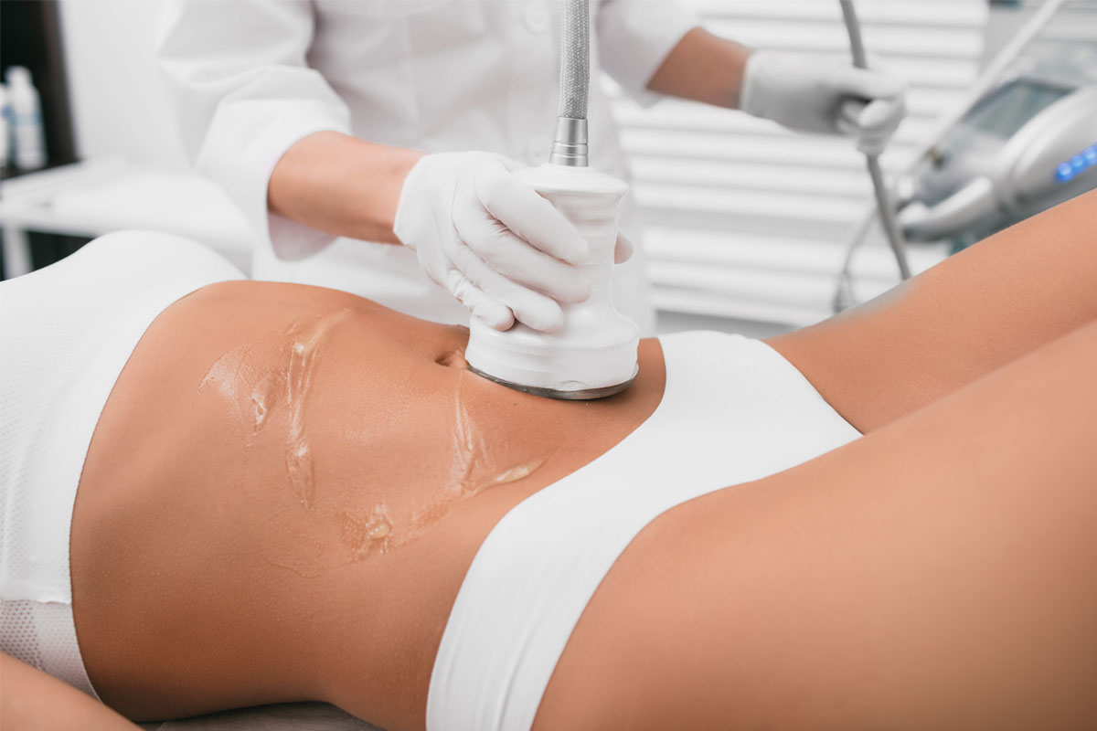 The laser's causes your skin to produce collagen