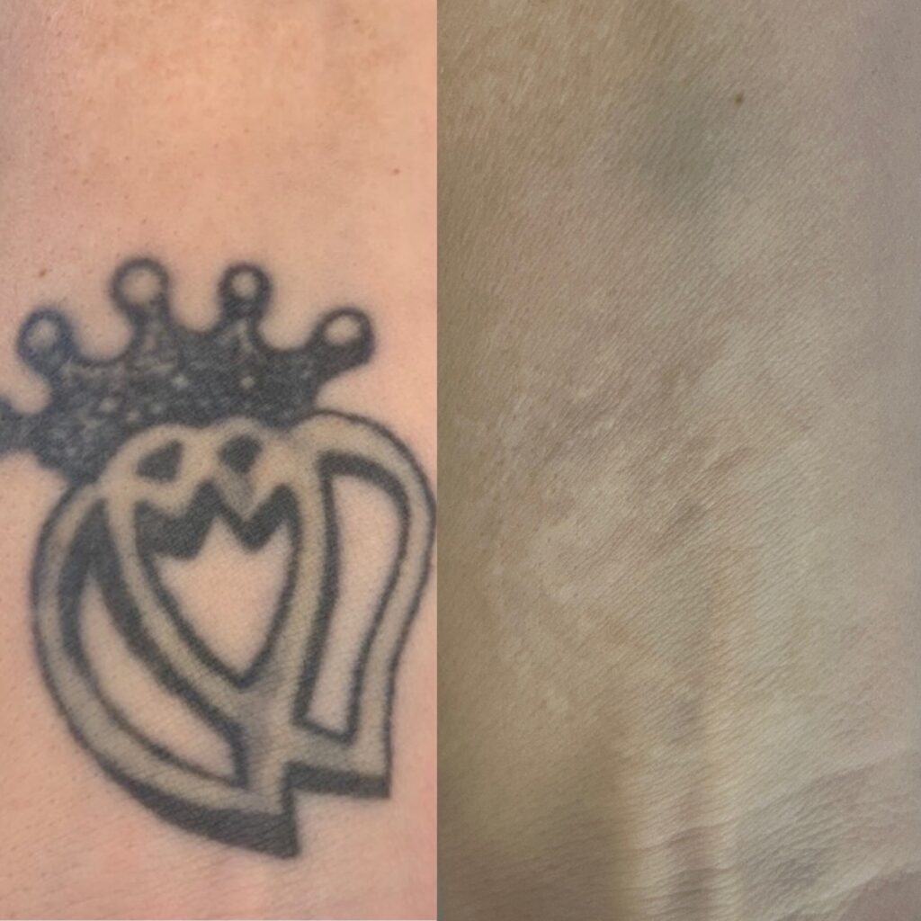 tat