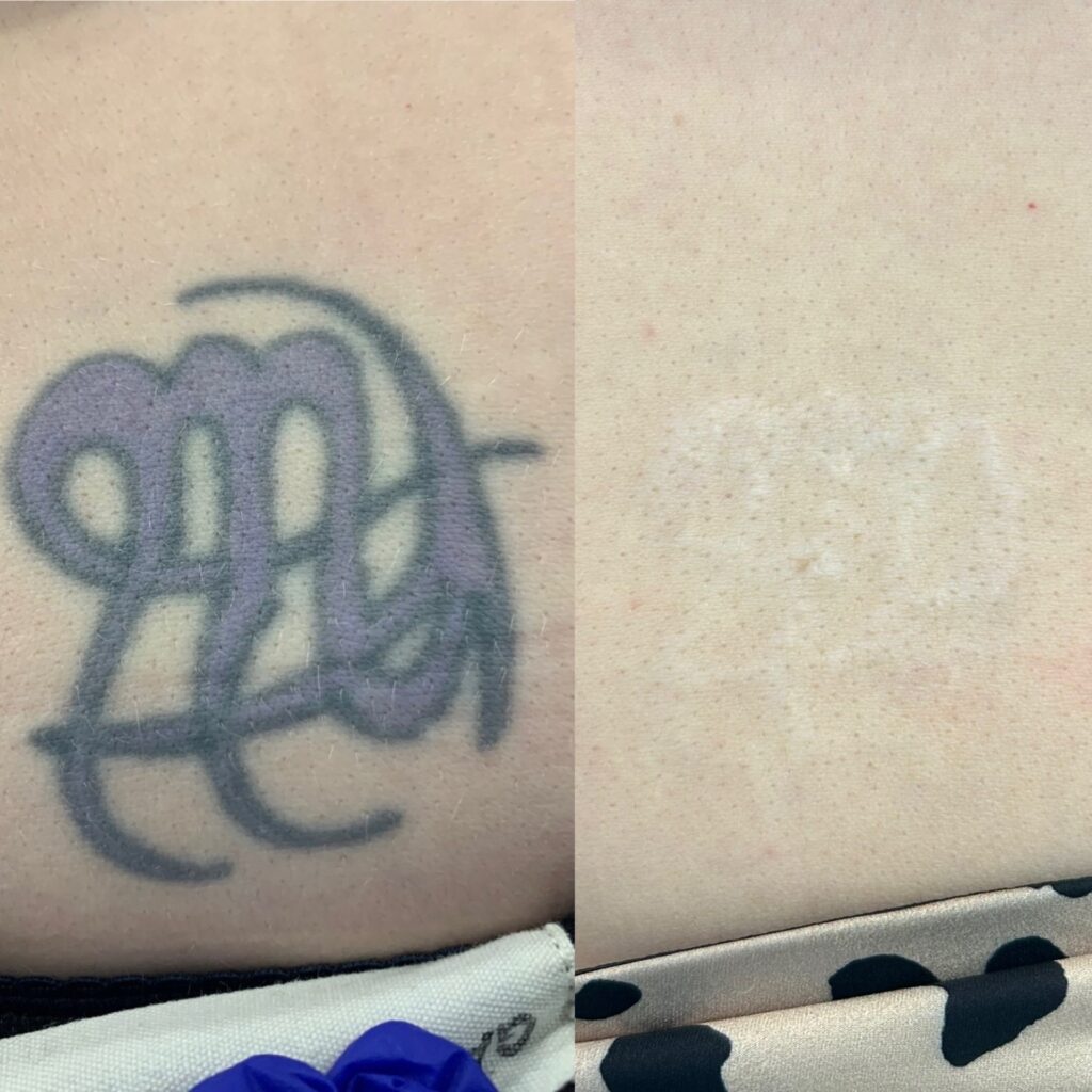 tat1