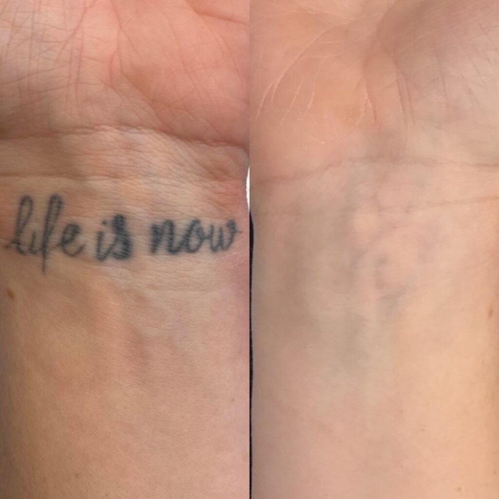 tat4